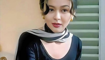 62岁关之琳现身韩国,脸部馒化颧骨凸出,戴黄金手镯 穿名牌好贵气