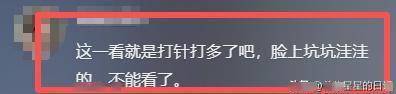 62岁关之琳现身韩国,脸部馒化颧骨凸出,戴黄金手镯 穿名牌好贵气
